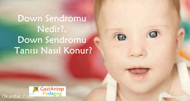 down sendromu nedir gaziantep pedagog cocuk psikolog